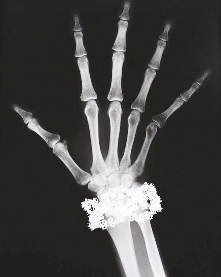 Building the Next Generation of Diagnostics